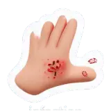 infection Infektion